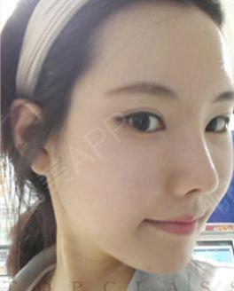 娛樂吃瓜醬不用做鼻子,揭秘明星隱私，不做鼻子也能暢游娛樂圈